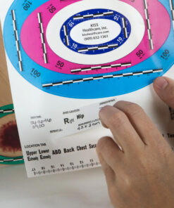Alternative view of Wound Ring Scales, Oval